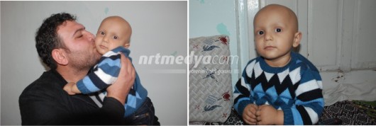 2 Yaşındaki Bekir, Kemik Nakli Bekliyor