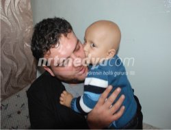 2 Yaşındaki Bekir, Kemik Nakli Bekliyor