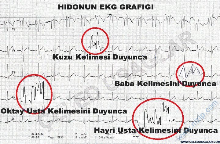 Her güne bir komiklik!.. :))