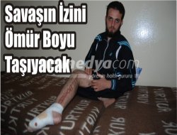 Video:   SAVAŞIN İZİNİ ÖMÜR BOYU TAŞIYACAK