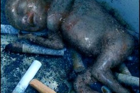 Brezilya'da Sigara Karşıtı kampanya.. (+18)