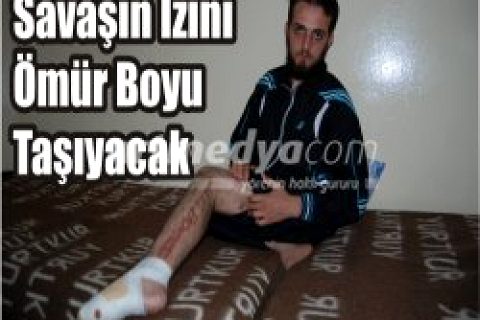 Video:   SAVAŞIN İZİNİ ÖMÜR BOYU TAŞIYACAK